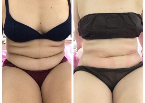 {{ $property->title }}の写真