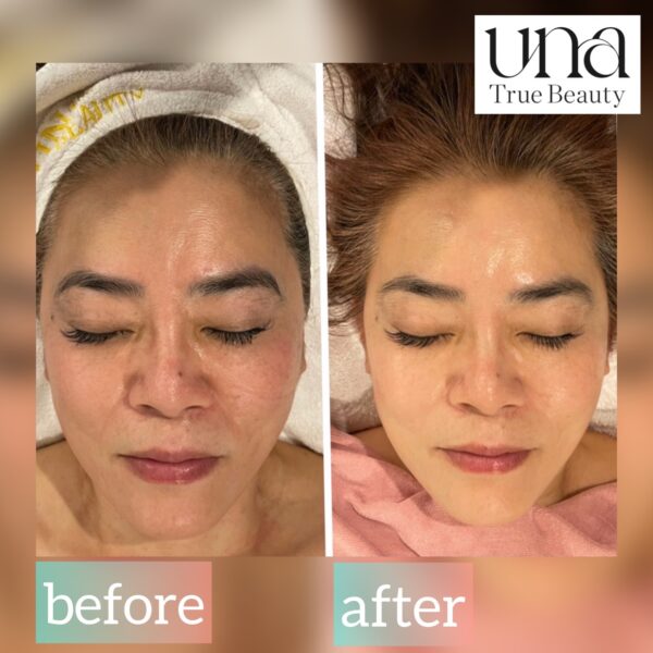 {{ $property->title }}の写真