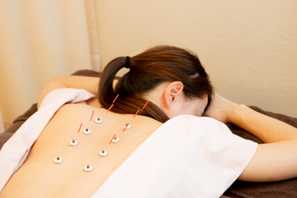 {{ $property->title }}の写真