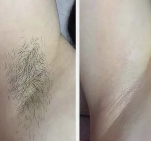 {{ $property->title }}の写真