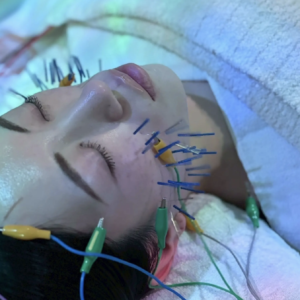 {{ $property->title }}のサムネイル