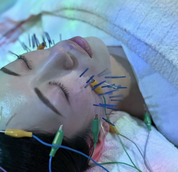 {{ $property->title }}の写真